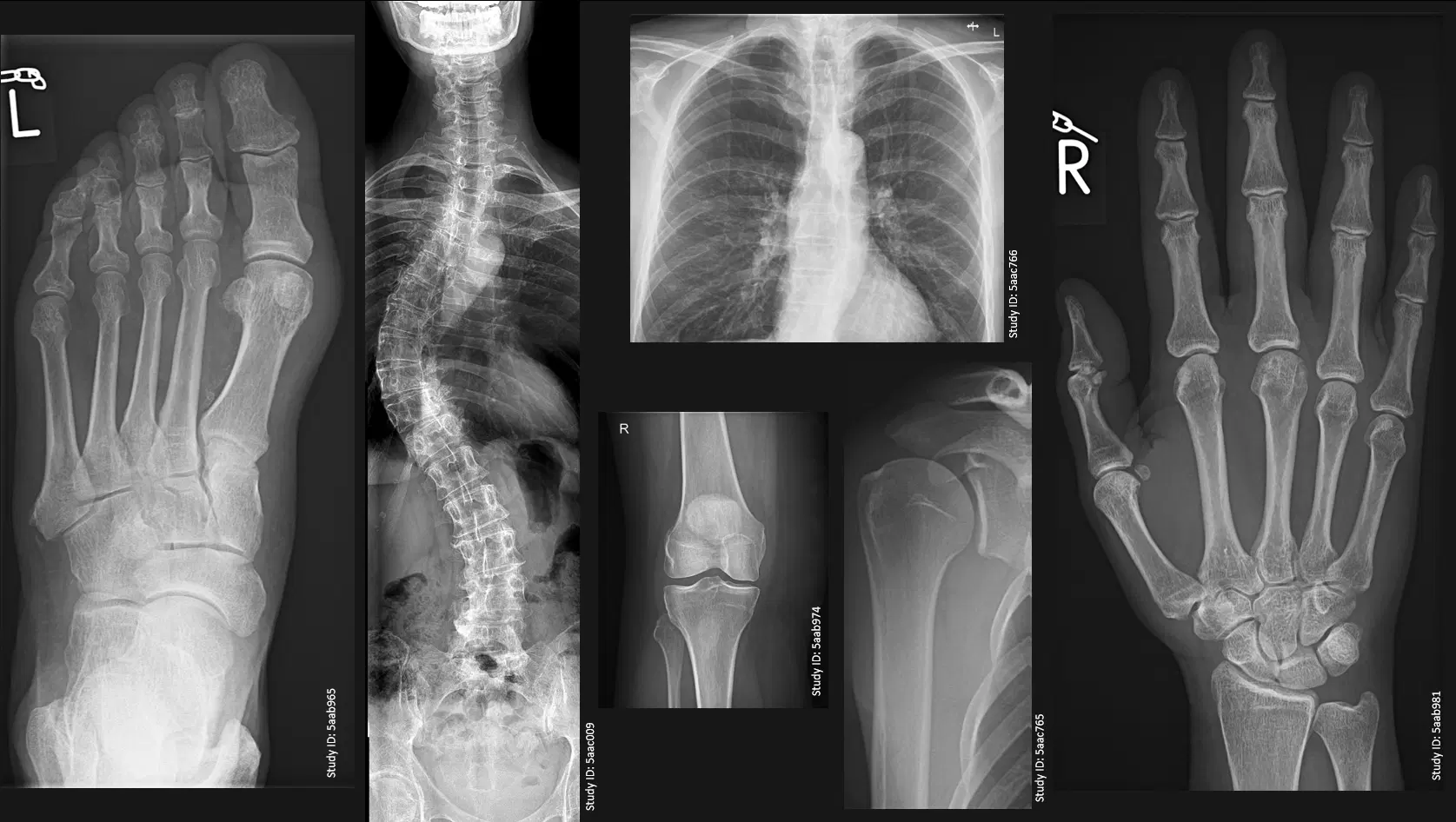 Radiografie Cluj-Napoca Medview